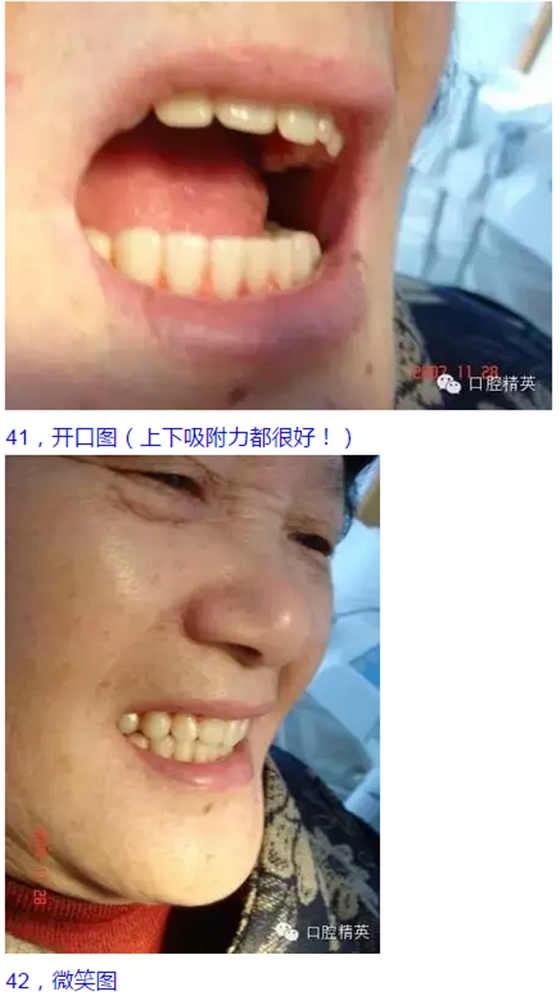 QQ圖片20150825104108.png