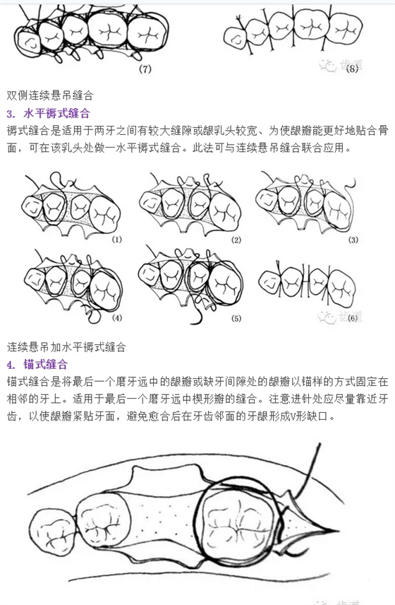 牙醫(yī)基本技能：口內(nèi)縫合術(shù)（文字、示意圖及視頻）