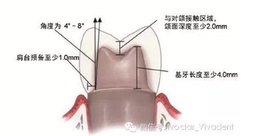 時常搞不清楚怎么備牙嗎？義獲嘉教您如何完美備牙