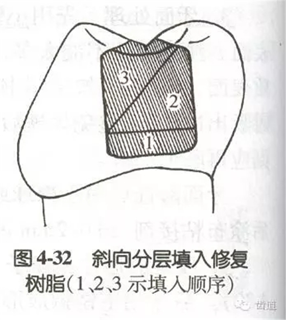 黏結(jié)修復(fù)的九大操作程序及九大失敗原因