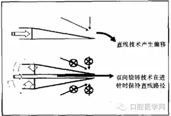 即使是老手也會失手的麻醉----下牙槽、舌、頰一次阻滯麻醉