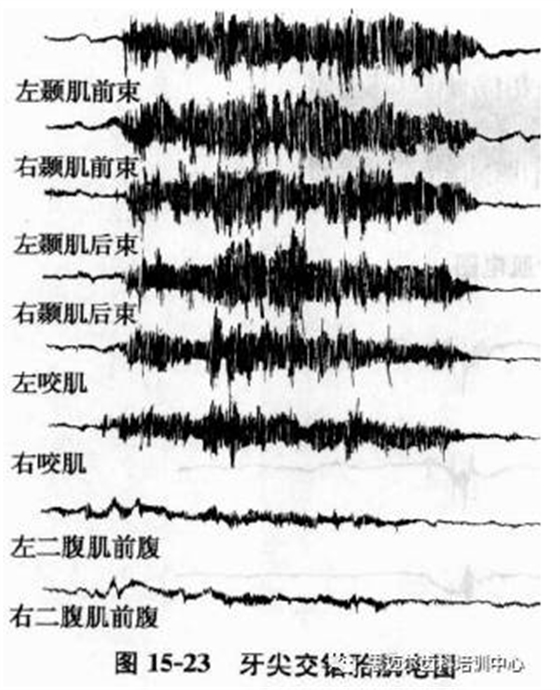 溫故知新 口腔解剖生理學(xué)（35）.png