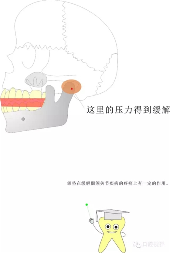 【愛牙科普知識300問】 “什么是頜（牙）墊？”