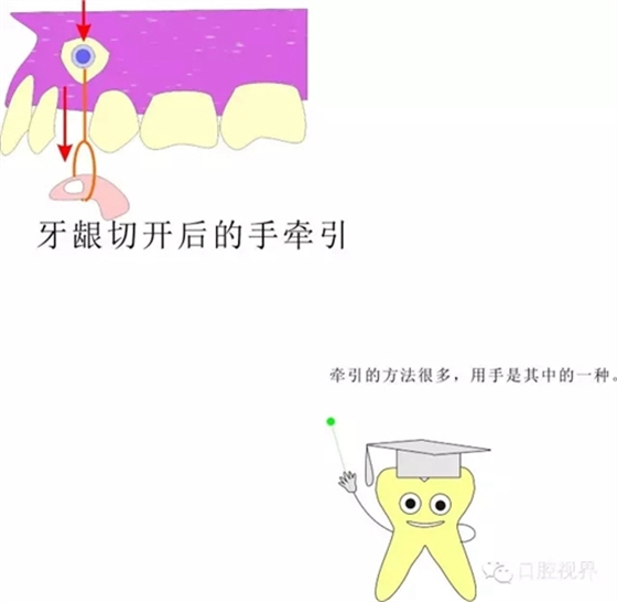 【愛牙科普知識300問】 “什么是頜（牙）墊？”