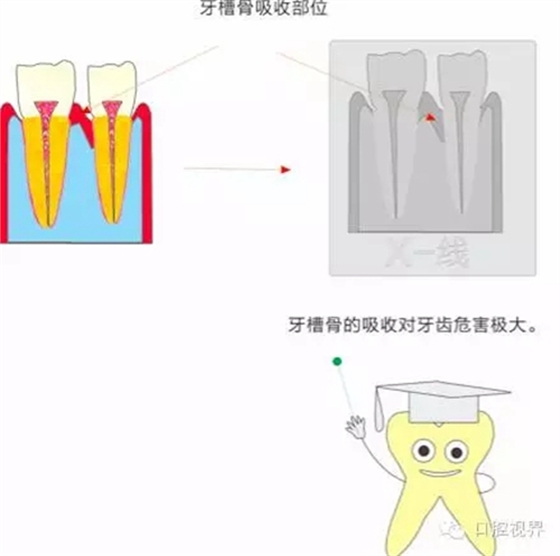 【愛牙科普知識(shí)300問】 “什么是牙齦萎縮？”