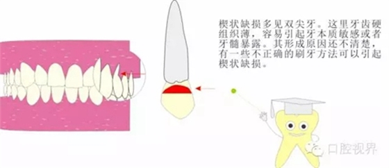 【愛牙科普知識(shí)300問】 “什么是牙齦萎縮？”