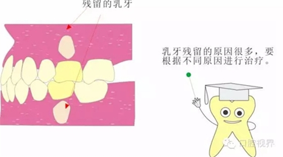 【愛牙科普知識(shí)300問】 “什么是牙齦萎縮？”