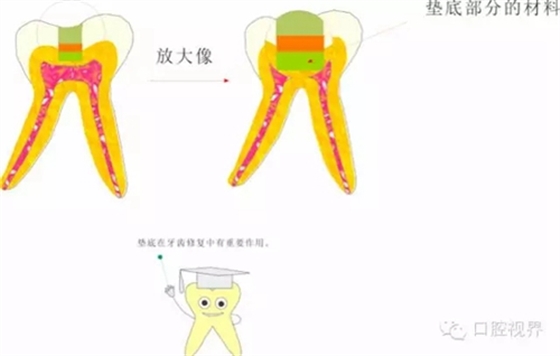 【愛牙科普知識300問】 “什么是活髓切斷術？”