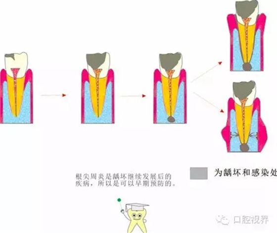 【愛牙科普知識(shí)300問】 “什么是牙本質(zhì)敏感？”