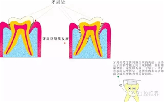 【愛牙科普知識(shí)300問】 “什么是牙本質(zhì)敏感？”