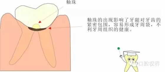 【愛牙科普知識300問】 “什么是融合牙、愈合牙和雙生牙？”