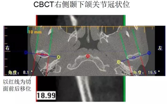 	口腔修復治療中，常見臨床接診流程