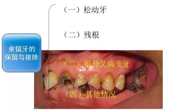 	口腔修復治療中，常見臨床接診流程