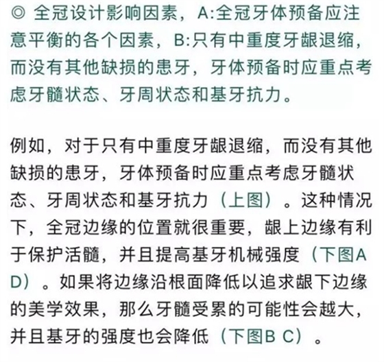 做全冠修復(fù)時基牙根面暴露，如何備牙？