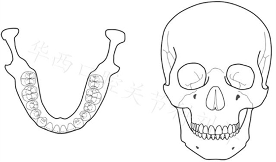 口腔材料對(duì)MRI檢查的影像到底有多大？  