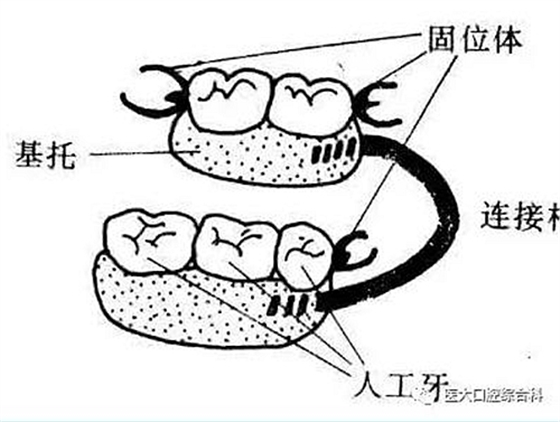 醫(yī)大口腔綜合科 |“鑲牙”的學(xué)問(wèn)——活動(dòng)類(lèi) 