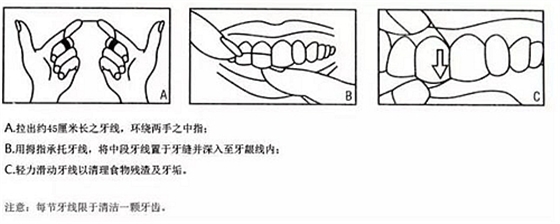 牙周病患者的外提升 梁光強(qiáng)