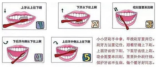 牙周病患者的外提升 梁光強(qiáng)