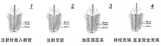 新熱熔充填系統(tǒng)C-Fill