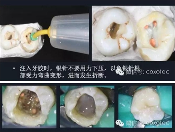 新熱熔充填系統(tǒng)C-Fill