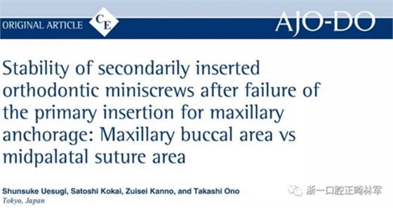 正畸文獻閱讀--上頜支抗初次植入失敗后二次植入穩(wěn)定性的研究