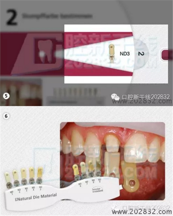 義獲嘉 Ivoclar Vivadent 比色板 A-D16色 Ivoclar Shade Guide A-D16