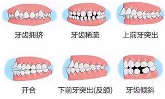 關于牙齒矯正，你想知道的都在這！