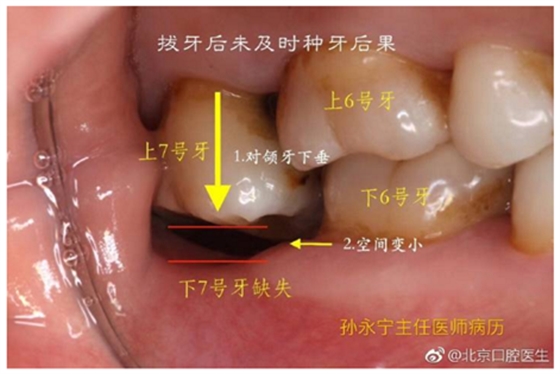 塞牙也是一種病