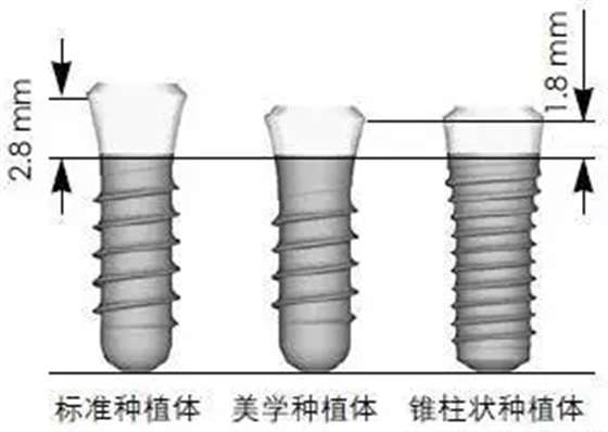 Sraumann種植系統(tǒng)外科操作流程