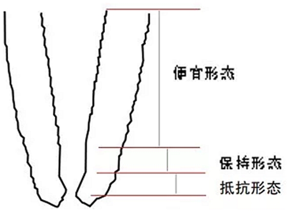 知識分享：規(guī)范化根管治療的細(xì)節(jié)分析