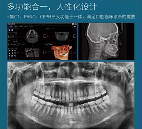 費(fèi)森影像