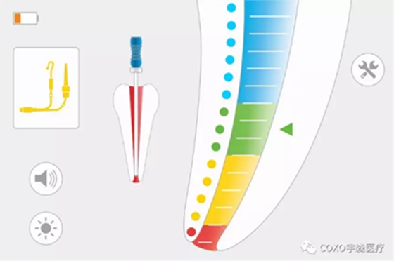 廠家來解說：多頻技術(shù)的根管長度測定儀