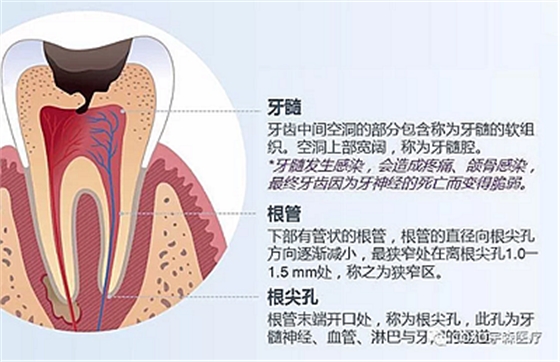 廠家來解說：多頻技術(shù)的根管長度測定儀