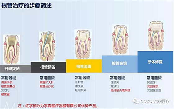 廠家來解說：多頻技術(shù)的根管長度測定儀