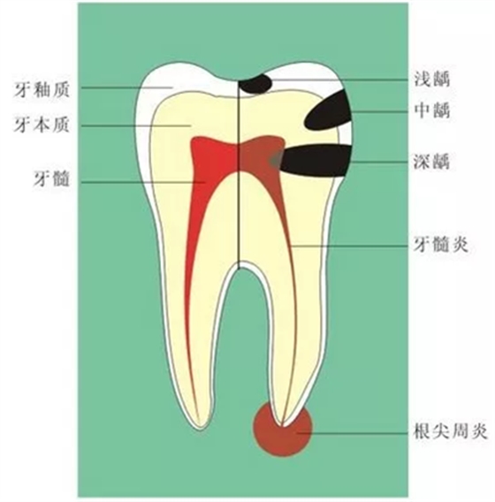 牙齦萎縮怎么辦？