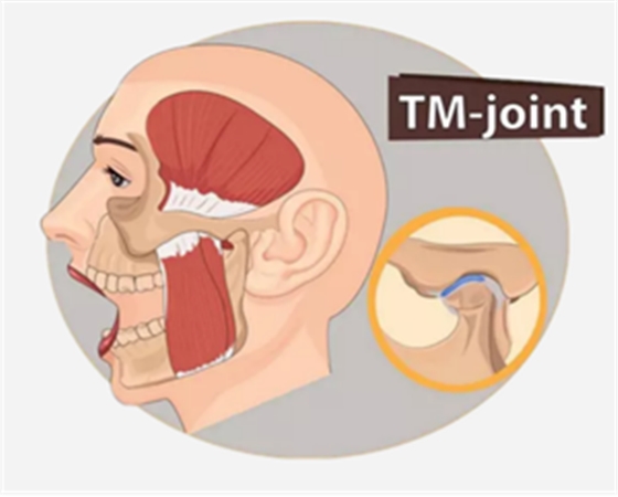 顳下頜關(guān)節(jié)紊亂病