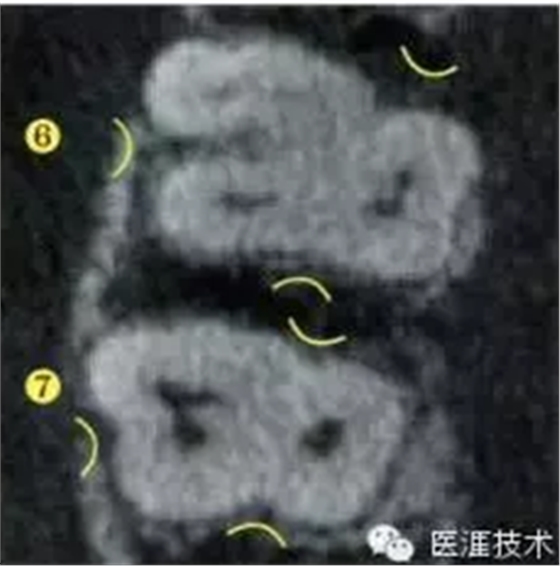 【牙周外科】牙齒的解剖形態(tài)（上篇）