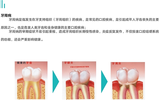 牙周病對(duì)健康的影響