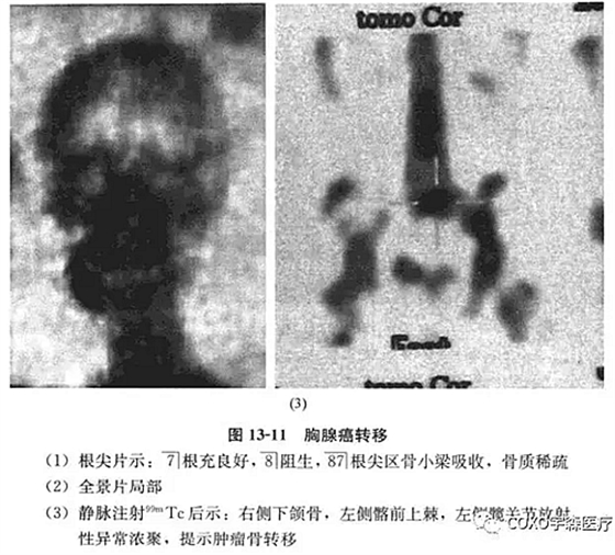 根尖周病的鑒別診斷