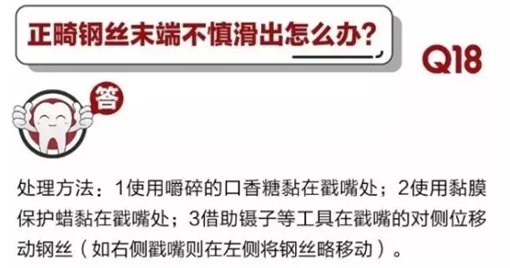 	 牙醫(yī)停診了？別怕，請您收下這份居家牙科急癥指南！