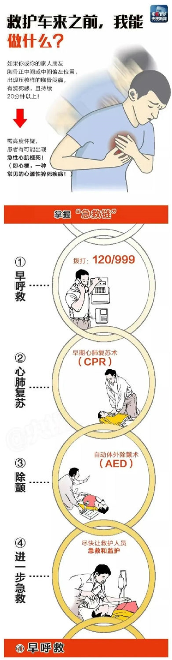 心肺復蘇