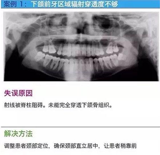 曲斷的10大經(jīng)典失誤案例及原因分析！