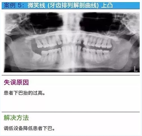 曲斷的10大經(jīng)典失誤案例及原因分析！