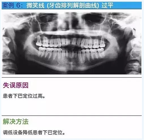 曲斷的10大經(jīng)典失誤案例及原因分析！