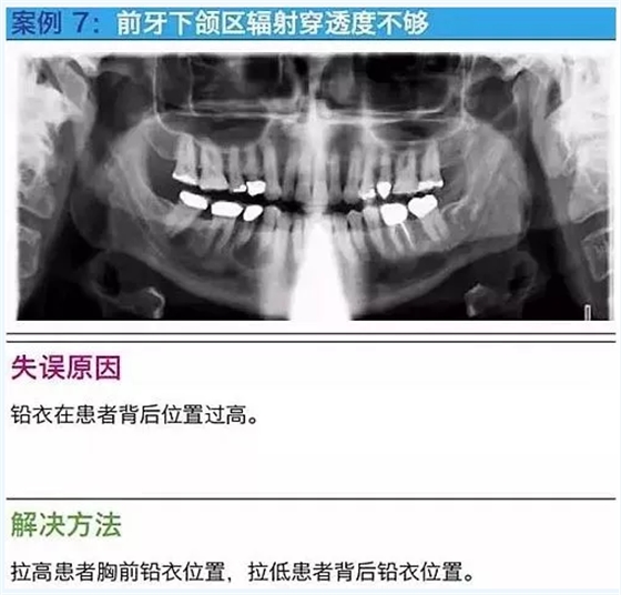 曲斷的10大經(jīng)典失誤案例及原因分析！