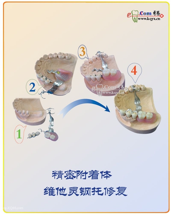 醫(yī)患溝通圖譜收集    推薦