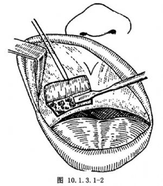 點(diǎn)擊查看原圖