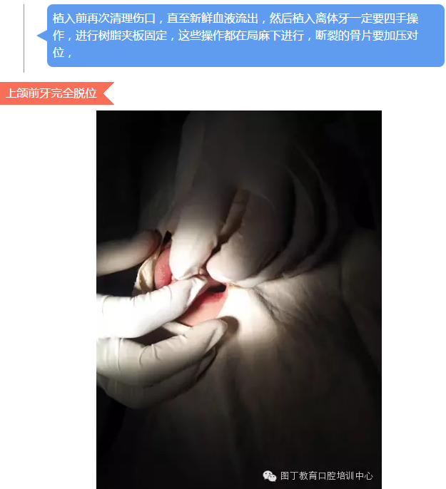 QQ圖片20150813150651.png