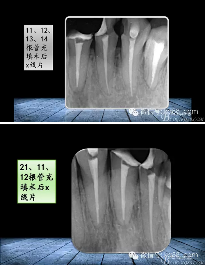 QQ圖片20150817141009.png