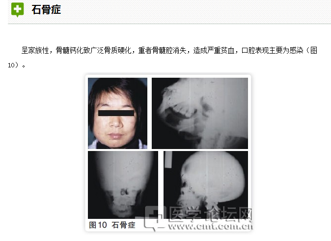 口腔疾病與全身系統(tǒng)性疾病的關系